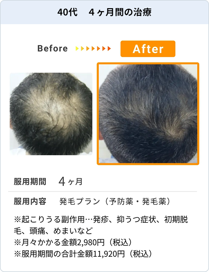 40代 4ヶ月間の治療