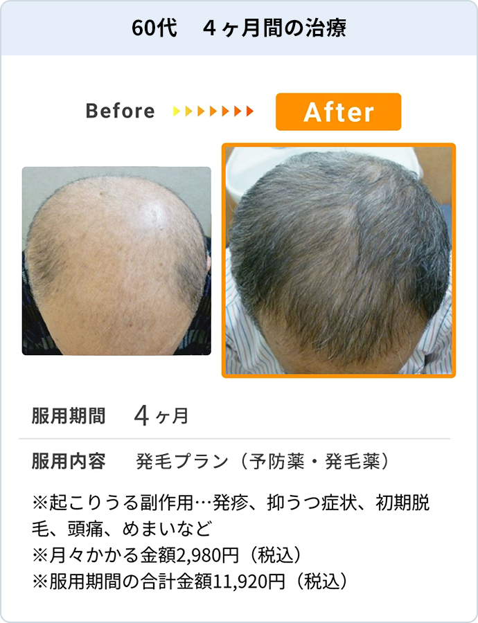 60代 4ヶ月間の治療